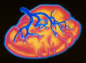 Computer graphic of human spleen with its artery Computer graphic of human spleen with its artery