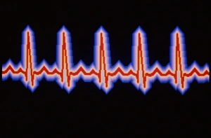 Computer illustration of a healthy heartbeat Computer illustration of a healthy heartbeat