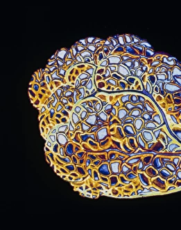 Computer illustration showing alveoli Computer illustration showing alveoli