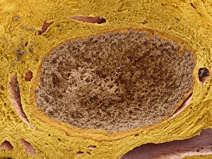 Corpus luteum, SEM Corpus luteum, SEM