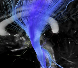 Corticospinal tract, DTI MRI scan C017/7046 Corticospinal tract, DTI MRI scan C017/7046