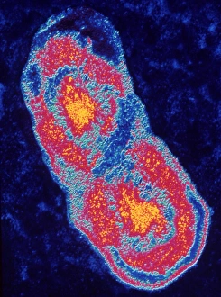 Coxiella burnetti bacterium dividing Coxiella burnetti bacterium dividing