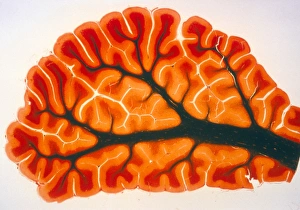 Cross-section of cortex & medulla of cerebellum Cross-section of cortex & medulla of cerebellum