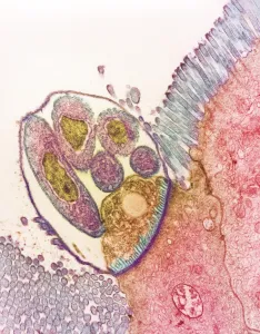 Cryptosporidium protozoa, TEM Cryptosporidium protozoa, TEM