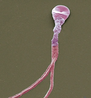 Prints of Deformed sperm cell. Coloured scanning electron micrograph (SEM) of double-tailed sperm cell, or spermatozoon. A sperm cells motility may be seriously affected by having multiple heavy tails Images Dated 2011 March: Deformed sperm cell Print, SEM image