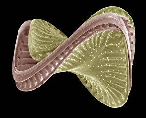 SEM Print of Campylodiscus costatus Diatom