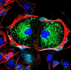Cell Division Prints: Dividing cell, light micrograph