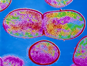 Bacterial Division Process Prints: Dividing Streptococcus sp. bacterium