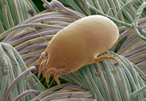 Scanning Electron Micrograph Prints: Dust mite