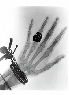 Early X-ray photograph of a hand taken in 1896 Early X-ray photograph of a hand taken in 1896
