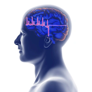 ECG trace and head with brain, artwork ECG trace and head with brain, artwork