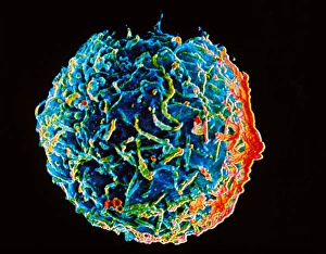 Electron micrograph of B-lymphocyte blood cell Electron micrograph of B-lymphocyte blood cell