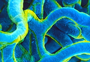 Electron micrograph of blood capillaries in muscle Electron micrograph of blood capillaries in muscle