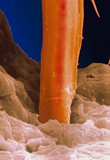 Electron micrograph of cat flea stylet in skin Electron micrograph of cat flea stylet in skin