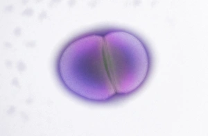 Electron Microscopy Images Prints: Enterococcus faecalis dividing, TEM