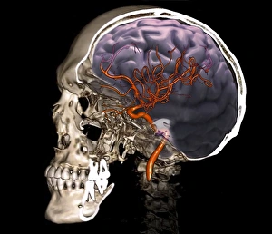 External carotid artery, 3D CT scan C016/6341 External carotid artery, 3D CT scan C016/6341
