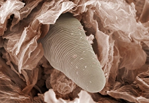 Eyelash mite tail, SEM Eyelash mite tail, SEM