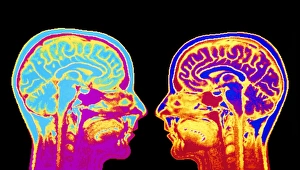 F/col MRI mid-sagittsal scan of normal brain F/col MRI mid-sagittsal scan of normal brain