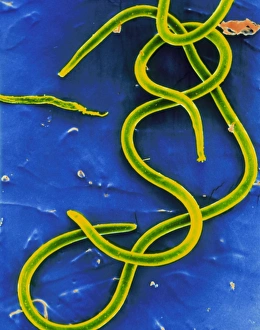 F/col SEM of mirofilariae (larval roundworms) F/col SEM of mirofilariae (larval roundworms)