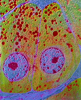 F/col TEM of acinar cells in exocrine pancreas F/col TEM of acinar cells in exocrine pancreas