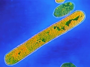 F/col TEM of Clostridium tetani bacterium F/col TEM of Clostridium tetani bacterium