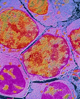 F/col TEM of erythroblast in bone marrow F/col TEM of erythroblast in bone marrow