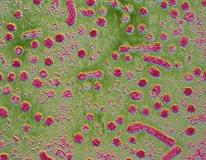 F/col TEM of hepatitis B virus particles F/col TEM of hepatitis B virus particles