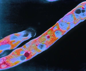 F/col TEM of Mycobacterium tuberculosis F/col TEM of Mycobacterium tuberculosis
