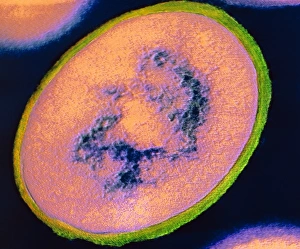 Staphylococcus Aureus Bacteria Prints: F / col TEM of Staphylococcus aureus