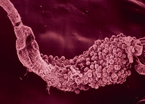 F. colour SEM of oocysts on stomach of Anopheles F. colour SEM of oocysts on stomach of Anopheles