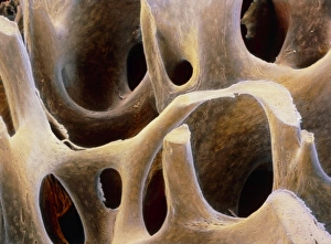 F. colour SEM of trabeculae in spongy bone tissue F. colour SEM of trabeculae in spongy bone tissue