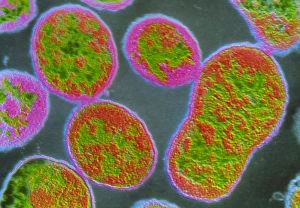 f/Colour TEM of Brucella abortus bacteria f/Colour TEM of Brucella abortus bacteria