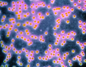 F-colour TEM of papillomavirus from plantar wart F-colour TEM of papillomavirus from plantar wart