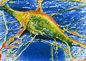 False-col SEM of single neurone of cerebral cortex False-col SEM of single neurone of cerebral cortex
