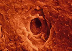 False col SEM of skin from blister on human hand False col SEM of skin from blister on human hand