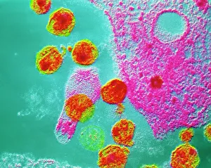 False-col TEM of AIDS virus inside T-cell False-col TEM of AIDS virus inside T-cell