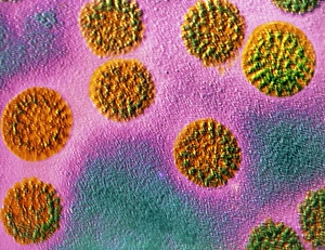 False-col TEM of rotaviruses False-col TEM of rotaviruses