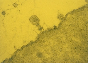 False-col TEM of T4 bacteriophage in E. coli False-col TEM of T4 bacteriophage in E. coli