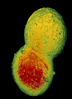 False-colour SEM of 2 protoplasts fusing False-colour SEM of 2 protoplasts fusing