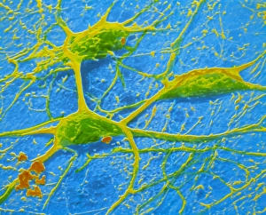 False-colour SEM of 3 neurones of cerebral cortex False-colour SEM of 3 neurones of cerebral cortex