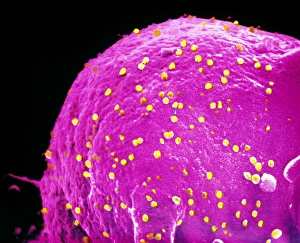 False-colour SEM of adenoviruses on red blood cell False-colour SEM of adenoviruses on red blood cell