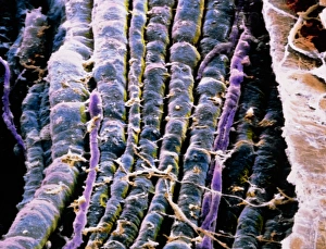 False-colour SEM of a bundle of motor nerve fibres False-colour SEM of a bundle of motor nerve fibres