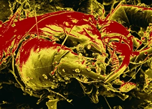 False-colour SEM of a dust mite Dermatophagoides False-colour SEM of a dust mite Dermatophagoides