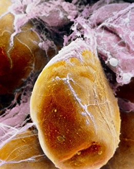 False-colour SEM of a fat cell (adipocyte) False-colour SEM of a fat cell (adipocyte)