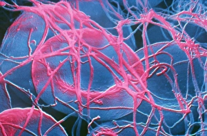 False-colour SEM of a human blood clot False-colour SEM of a human blood clot