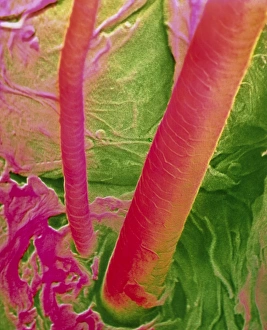 False-colour SEM of human hair & skin surface False-colour SEM of human hair & skin surface