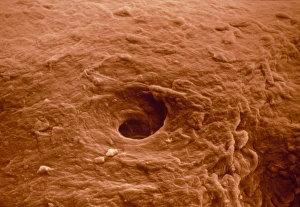 False-colour SEM of human skin from a blister False-colour SEM of human skin from a blister