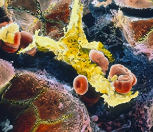 False-colour SEM of Kupffer cell in liver False-colour SEM of Kupffer cell in liver