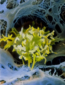 False-colour SEM of macrophage in liver False-colour SEM of macrophage in liver
