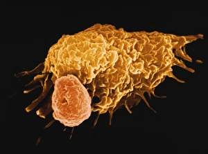 False-colour SEM of a macrophage & lymphocyte False-colour SEM of a macrophage & lymphocyte